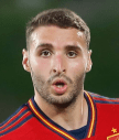 Abel Ruiz