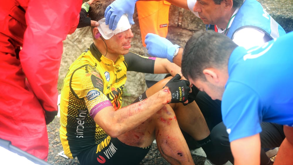 Schwer gezeichnet: Tony Martin.