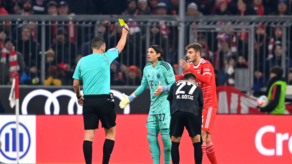 Wollte es nicht fassen: Yann Sommer (2. v.l.) sah gegen Frankfurt seine erste Gelbe Karte im Dress des FC Bayern.